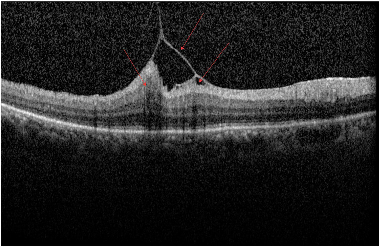 Figure 9
