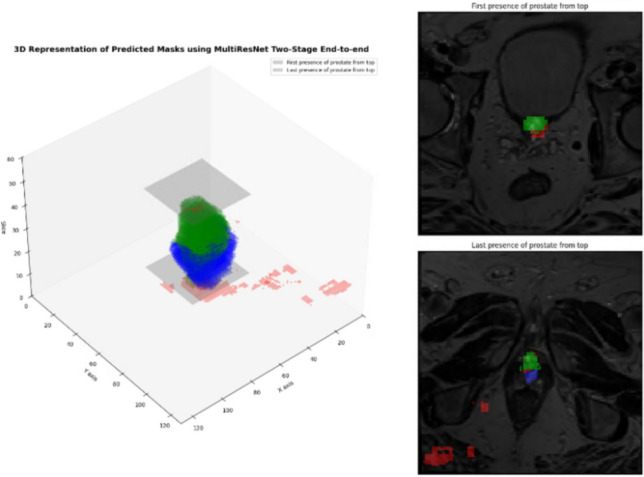 Figure 20