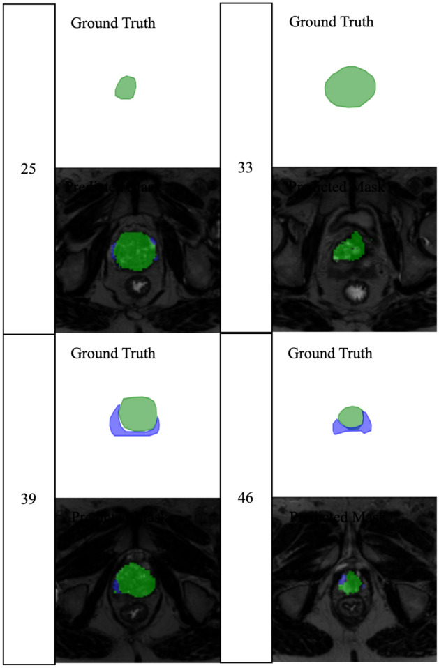 Figure 21