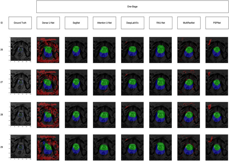 Figure 22