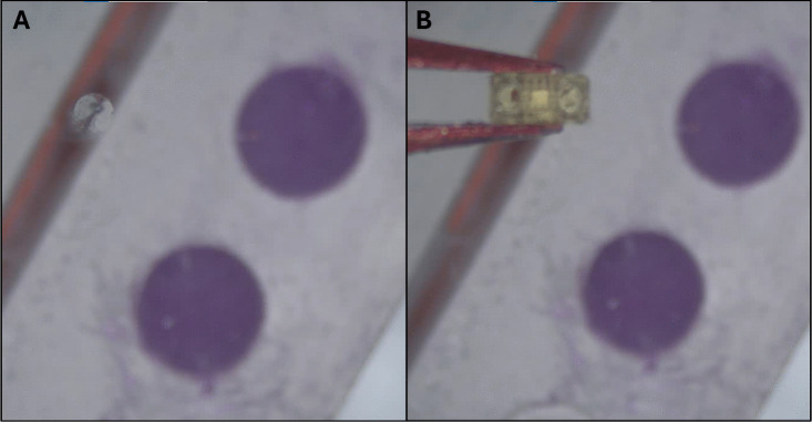 Figure 11