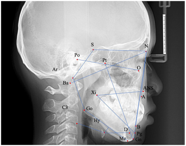 Figure 2