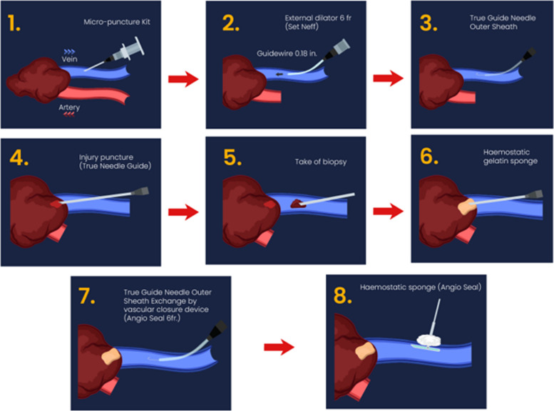 Figure 5