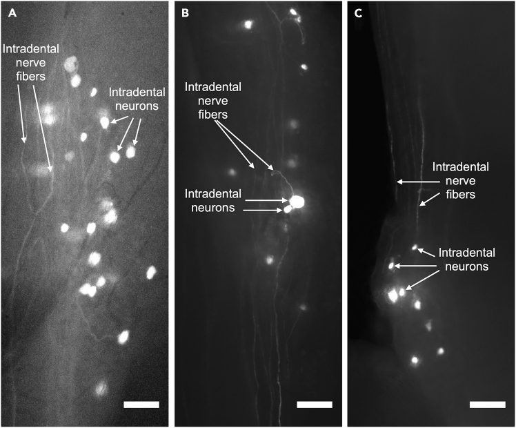 Figure 11