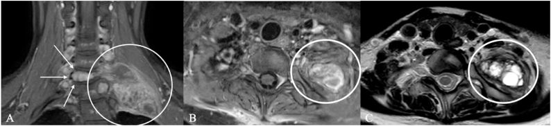 Figure 14