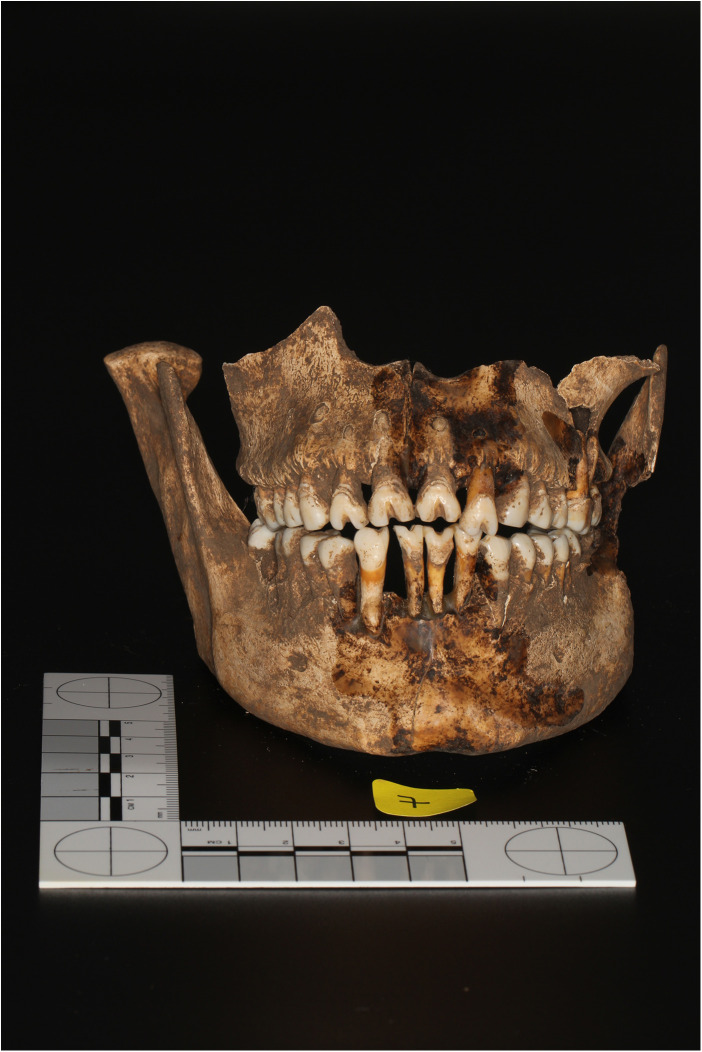 Figure 2