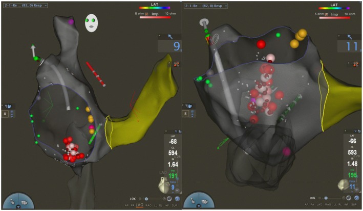 FIGURE 3