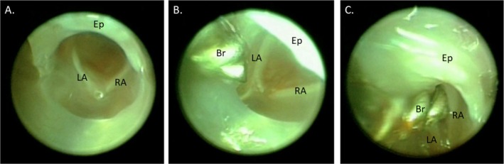 FIGURE 2