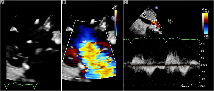 Figure 3