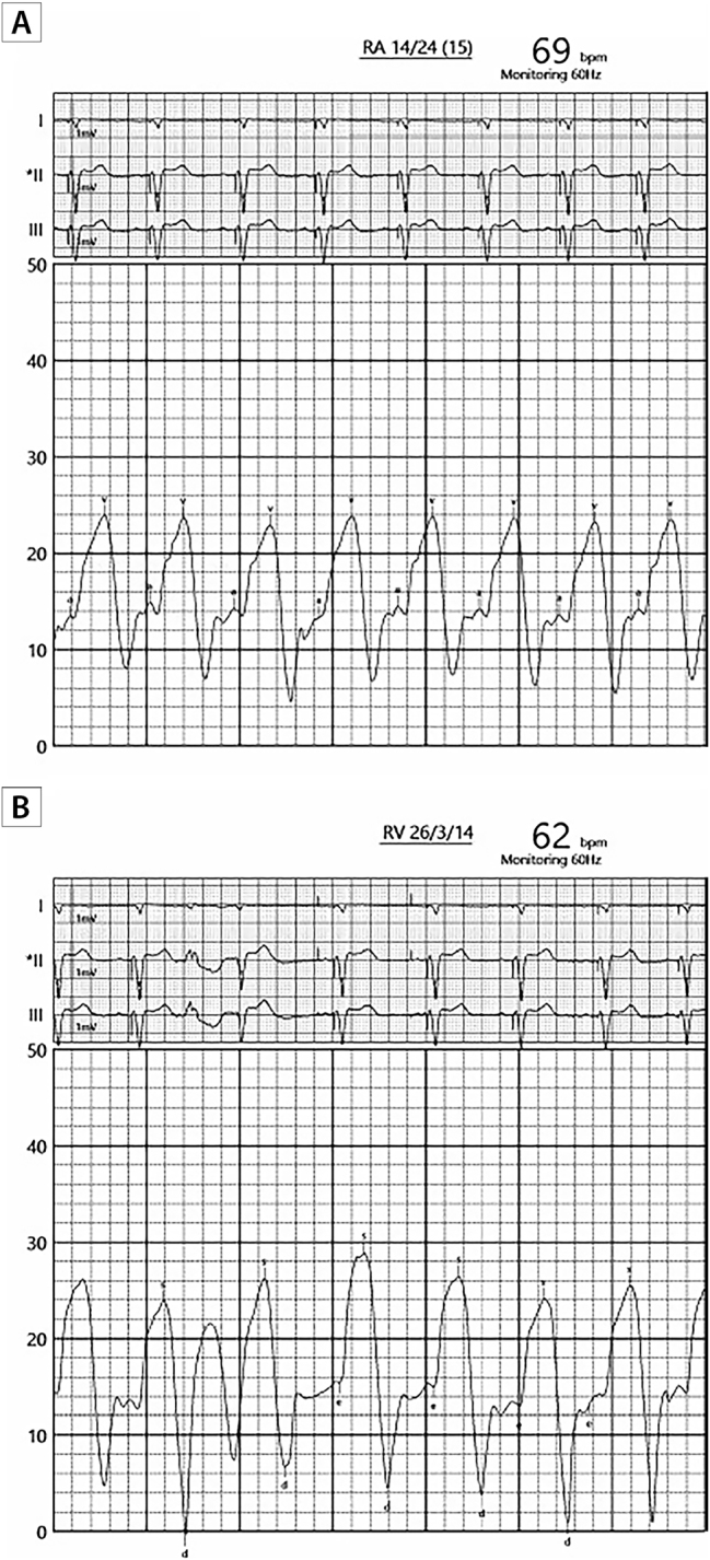 Figure 4