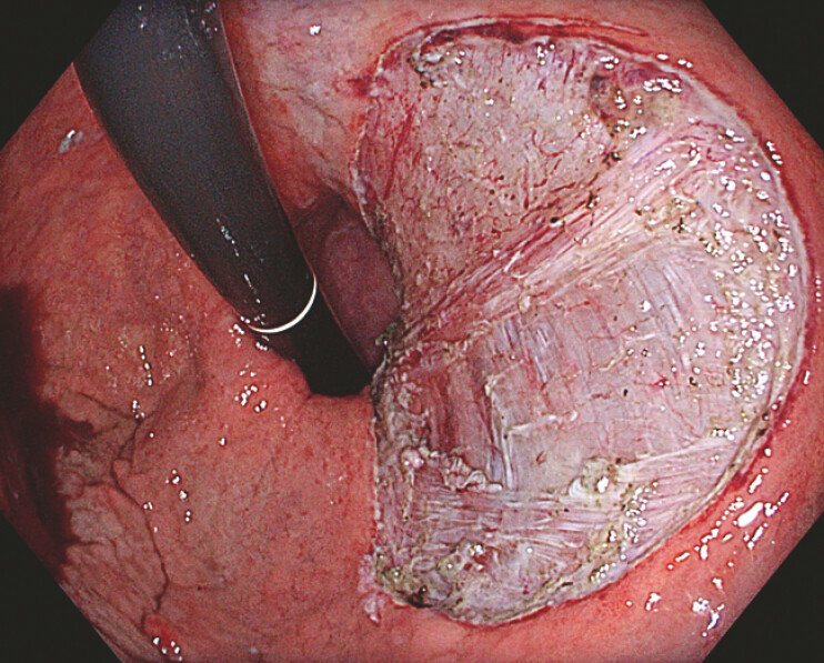 Fig. 4