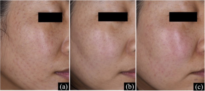 FIGURE 4