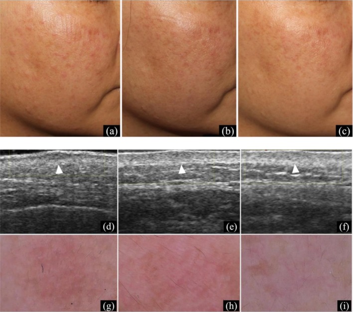 FIGURE 3