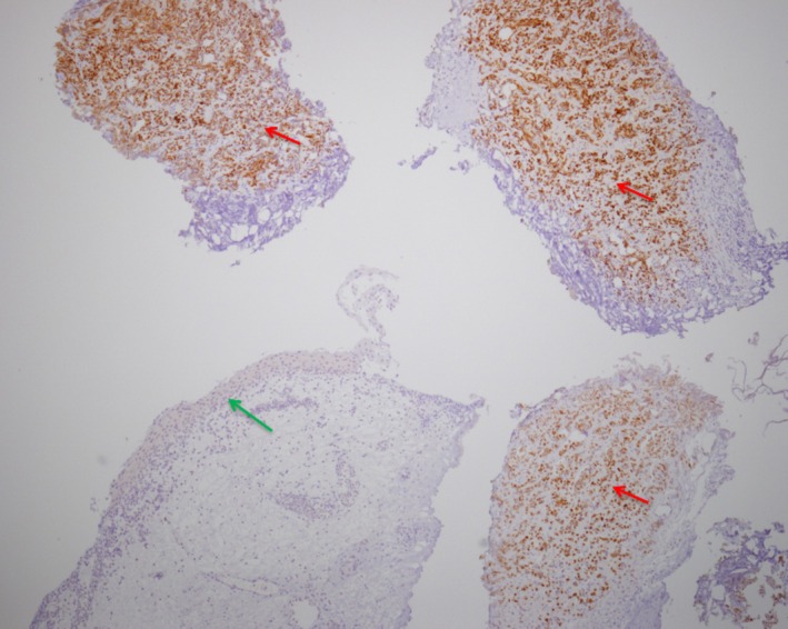 FIGURE 3