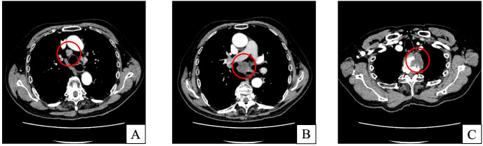 Figure 2