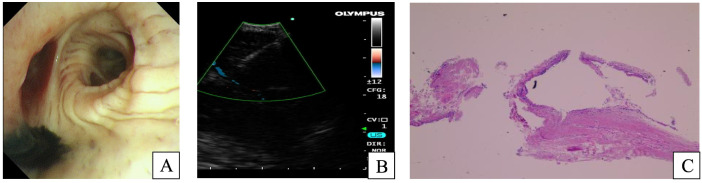 Figure 3