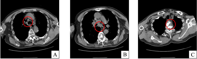 Figure 4