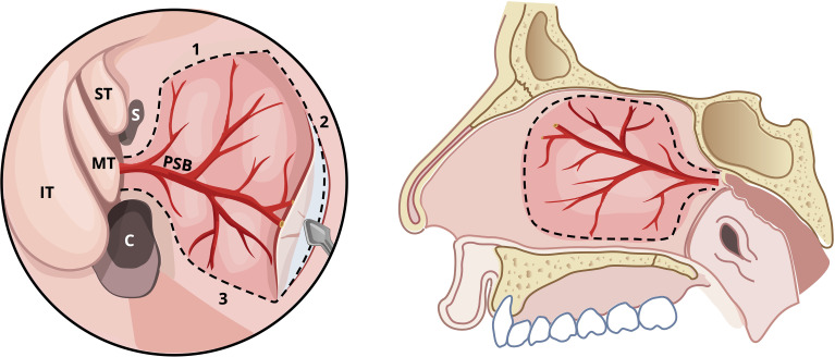 Figure 1