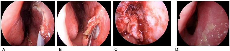 Figure 2