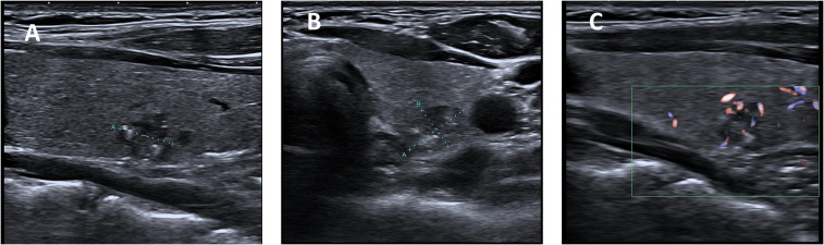 Figure 1
