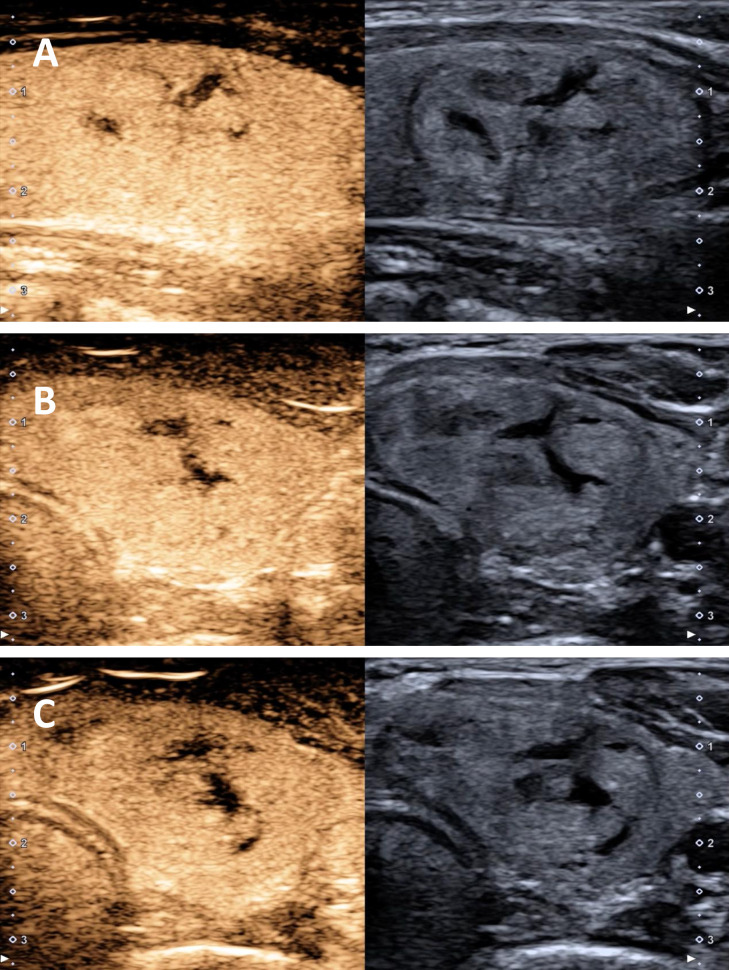Figure 4