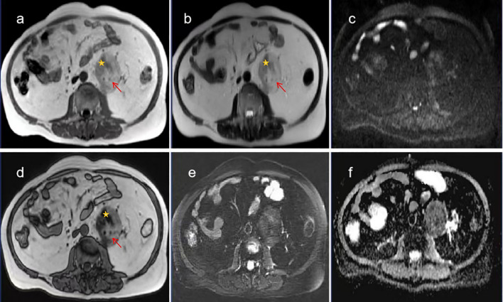Figure 3