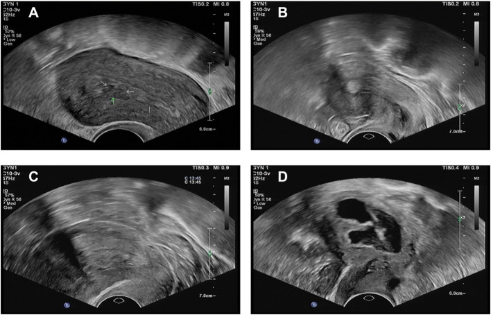 Figure 1