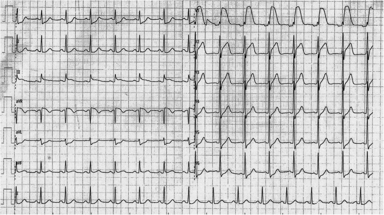Figure 1