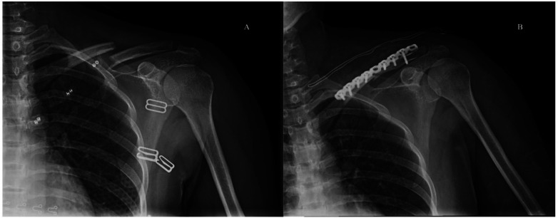 Figure 2