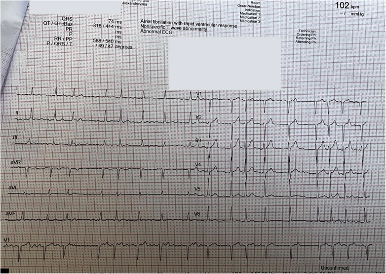 Figure 2