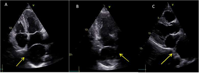 Figure 3