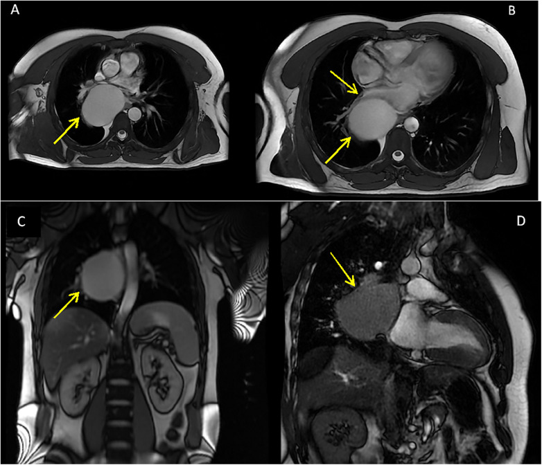 Figure 4