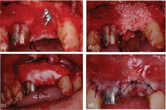 Figure 7