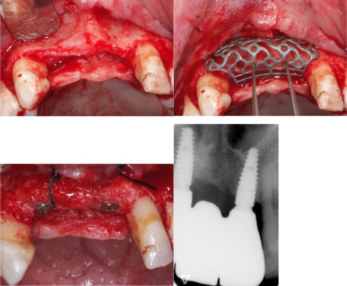 Figure 10
