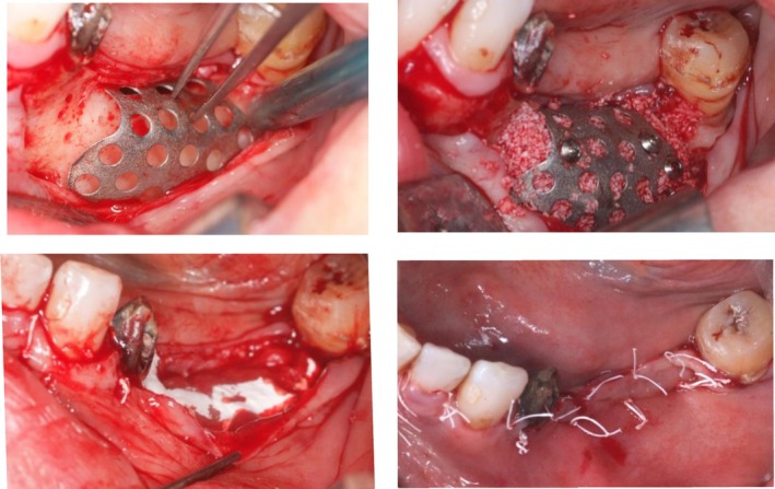 Figure 11