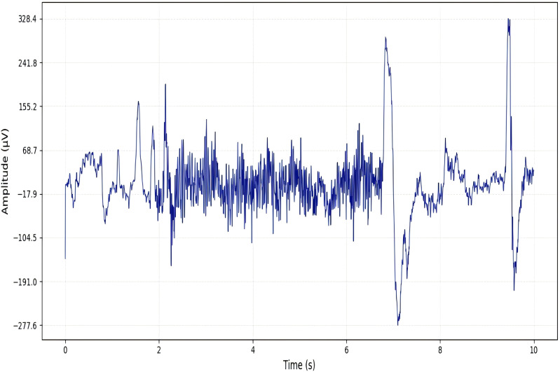 Figure 15