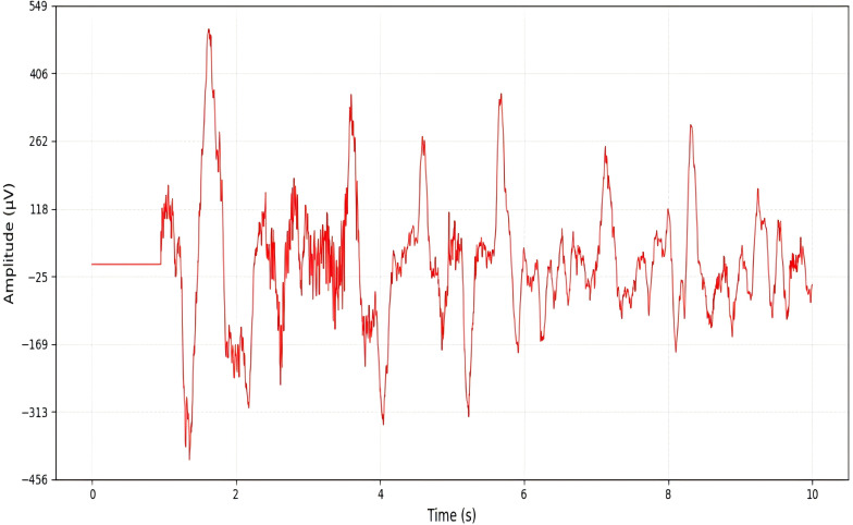 Figure 16