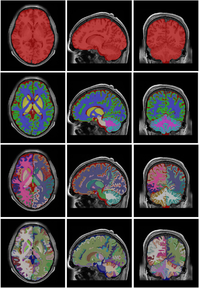 Figure 11