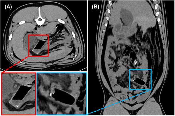 FIGURE 2