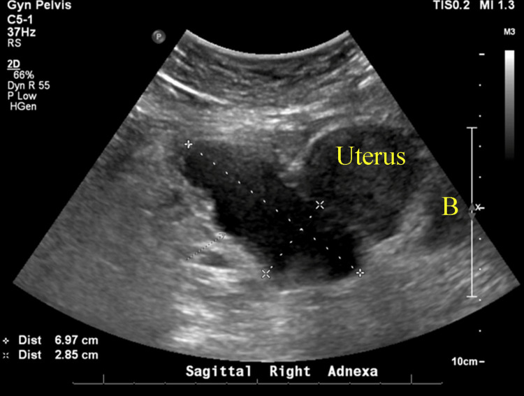 Figure 5