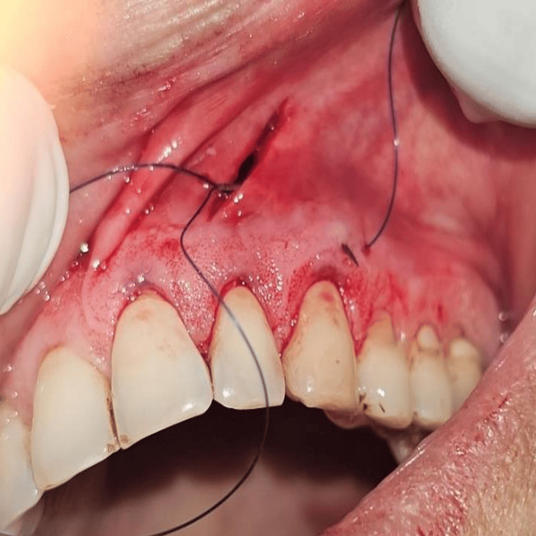 Figure 10