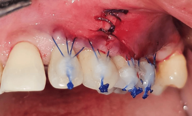 Figure 12