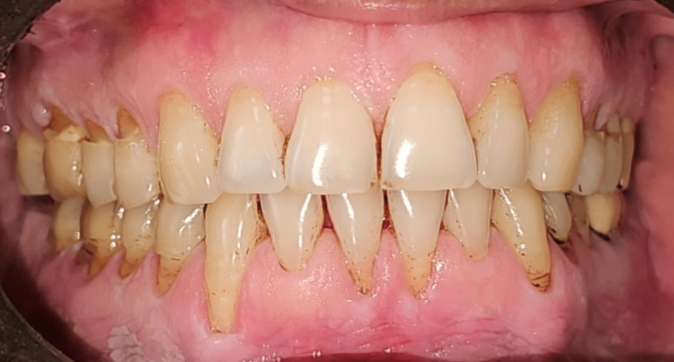 Figure 13