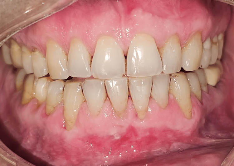 Figure 14