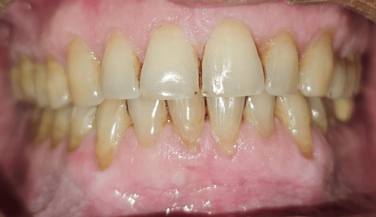 Figure 15