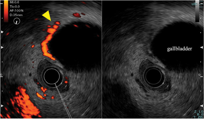 Fig. 2