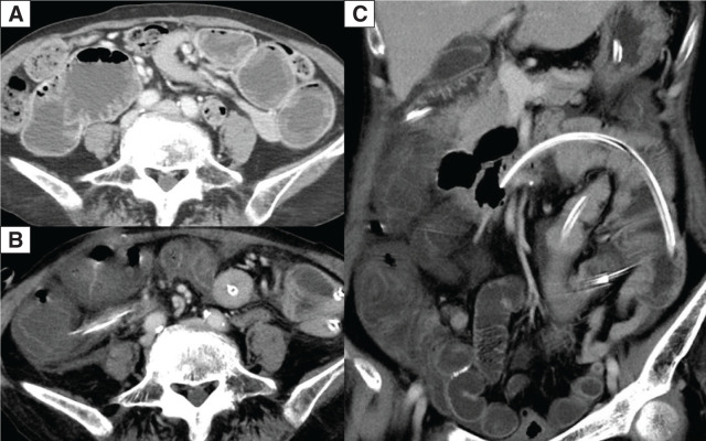 Fig. 2