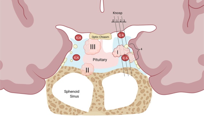FIGURE 1