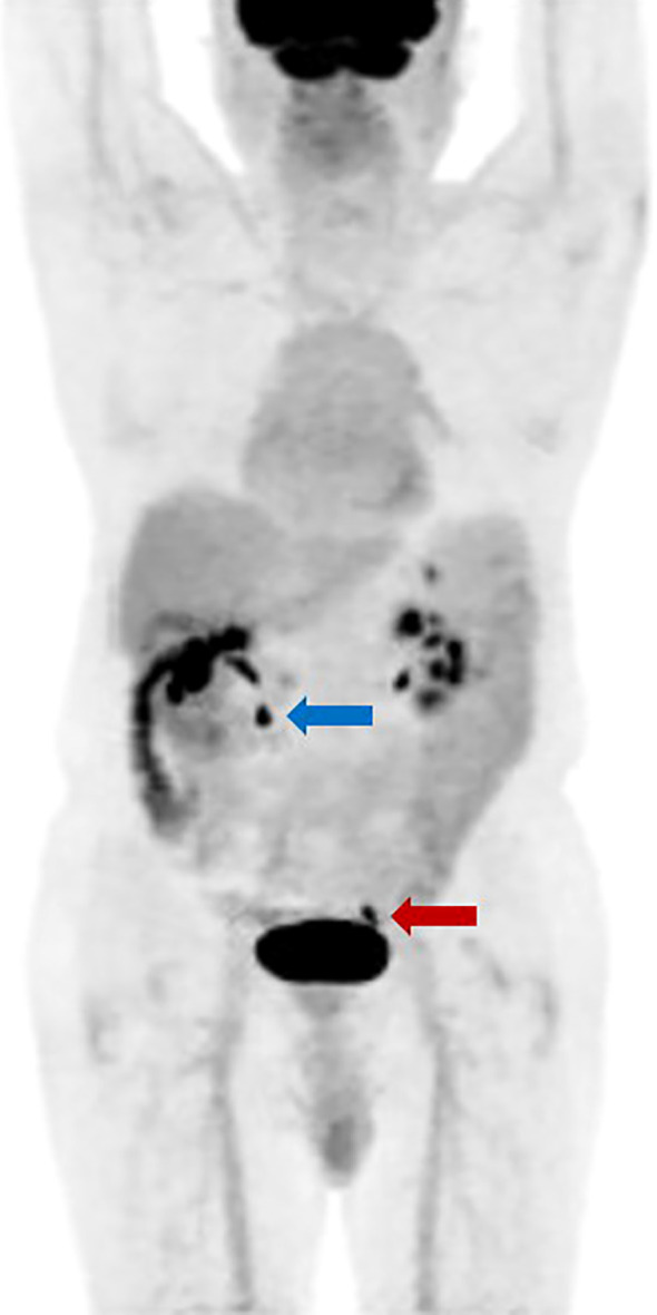 Figure 2