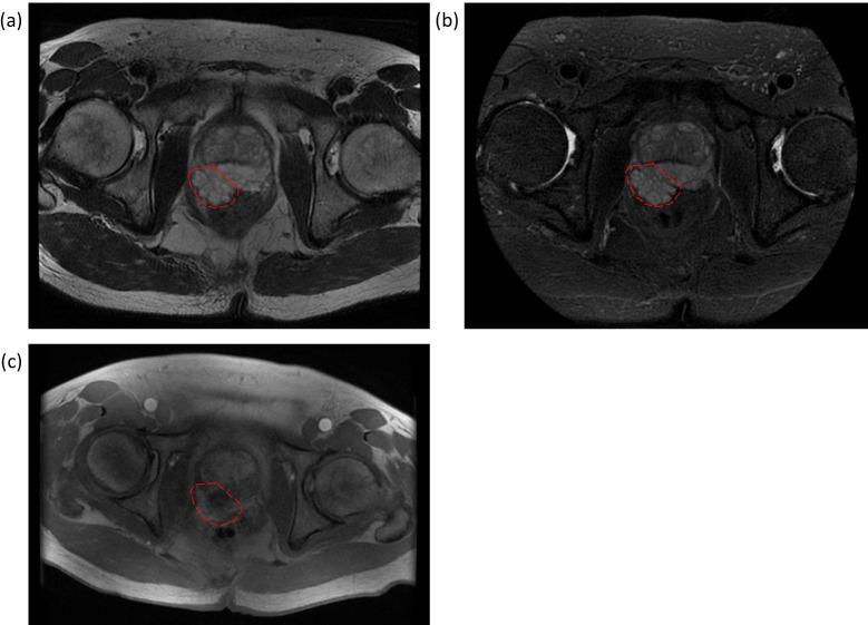 Figure 3